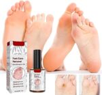 Foot Corn Removal Extra Strengthen Gel(10 ML) - Image 2