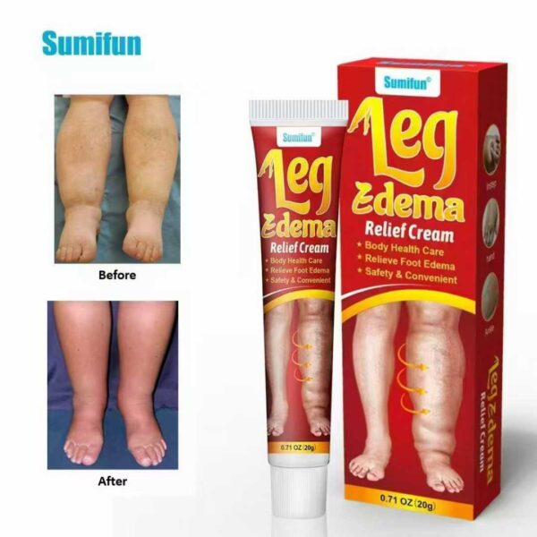 Sumifun Leg Edema Relief cream. - Image 1