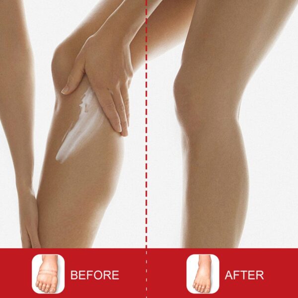 Sumifun Leg Edema Relief cream. - Image 3