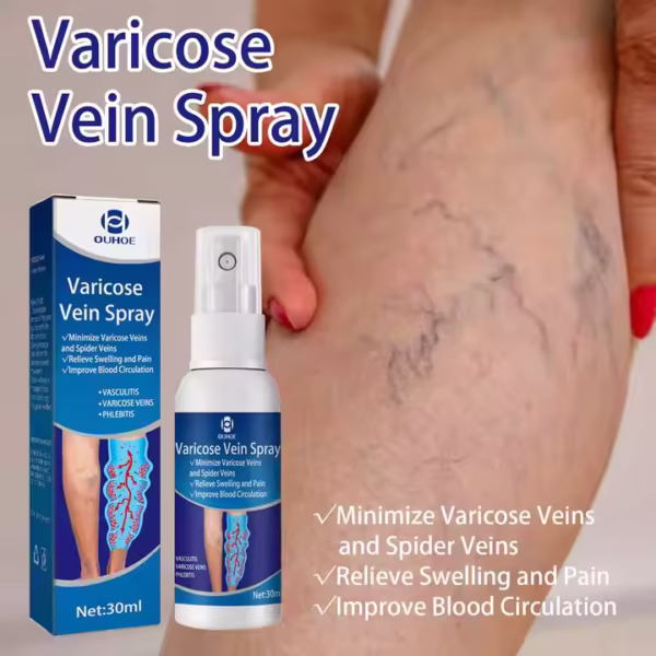 OUHOE Varicose Veins Treatment Spray!! - Image 3