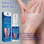 OUHOE Varicose Veins Treatment Spray!!