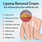 1 PC -South Moon™ Lipoma Treatment Ointment Cream - Image 5