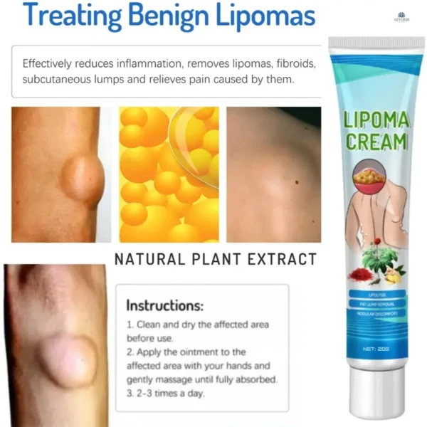 2 PC -South Moon™ Lipoma Treatment Ointment Cream - Image 6