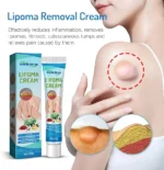 2 PC -South Moon™ Lipoma Treatment Ointment Cream