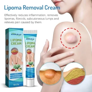 South Moon™ Lipoma Treatment Ointment Cream
