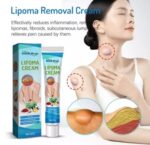 South Moon™ Lipoma Treatment Ointment Cream - Image 3