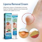 South Moon™ Lipoma Treatment Ointment Cream - Image 5