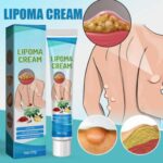 South Moon™ Lipoma Treatment Ointment Cream - Image 4