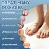BeamBalm Nail Fungus Treatment ( Made In China ) - Image 4
