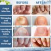 BeamBalm Nail Fungus Treatment ( Made In China ) - Image 6